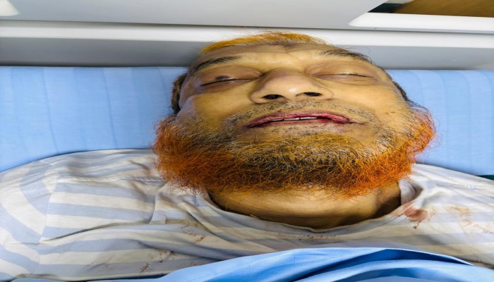 রাজাবাজারে গ্রিল কেটে চুরি: হাত-পা ও মুখ বেঁধে রাখায় হোমিও চিকিৎসকের মৃত্যু।