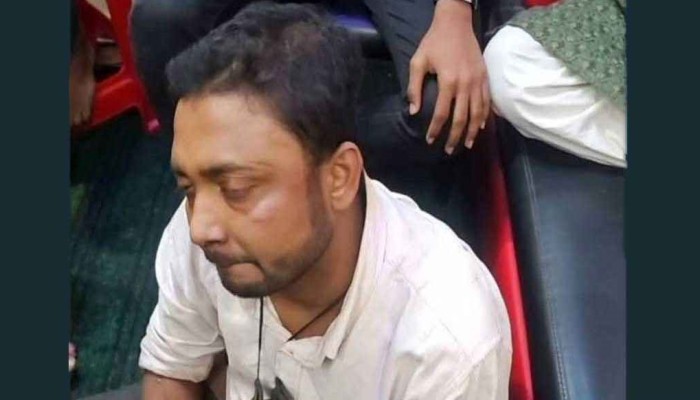 ছিনতাইকারীর হাতের কবজি কেটে দিল জনতা