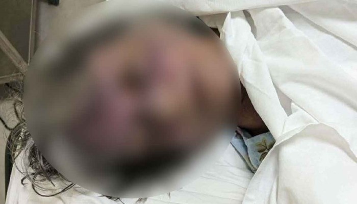 রাজধানীতে বিদেশি নাগরিককে পিটিয়ে হত্যার অভিযোগ